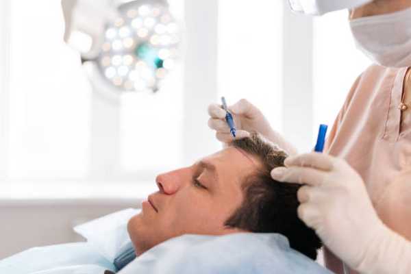 Hair Transplant Costs in 2025: UK vs Turkey Comparison